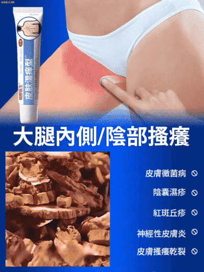 皮膚濕癢型醫用退燒凝膠