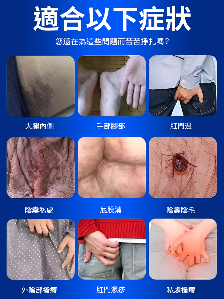 皮膚濕癢型醫用退燒凝膠