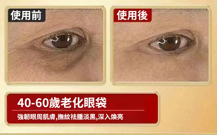 翻译件-SL-眼部黄芪精华抗皱眼部抗皱精华油-1240992-系统_15.png