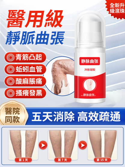 靜脈非曲張冷敷凝膠