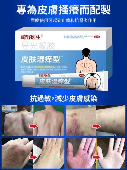 皮膚濕癢型醫用退燒凝膠