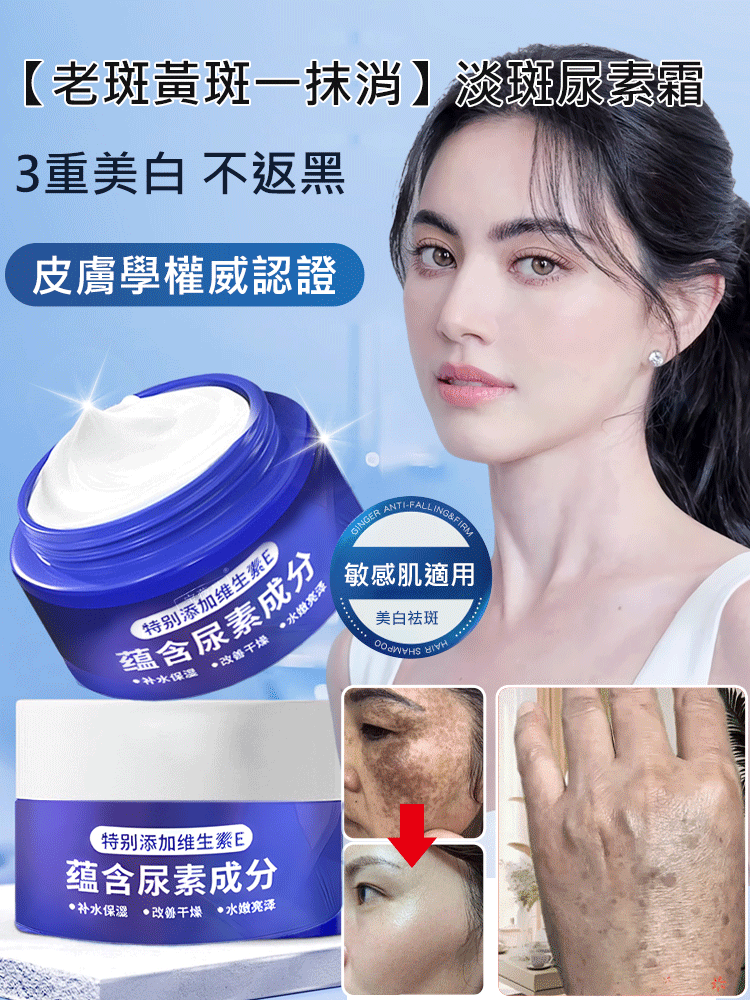 【老斑黃斑一抹消】淡斑尿素霜，富含維生素e和尿素精華，淡斑抗皺，適合早晚每天抹