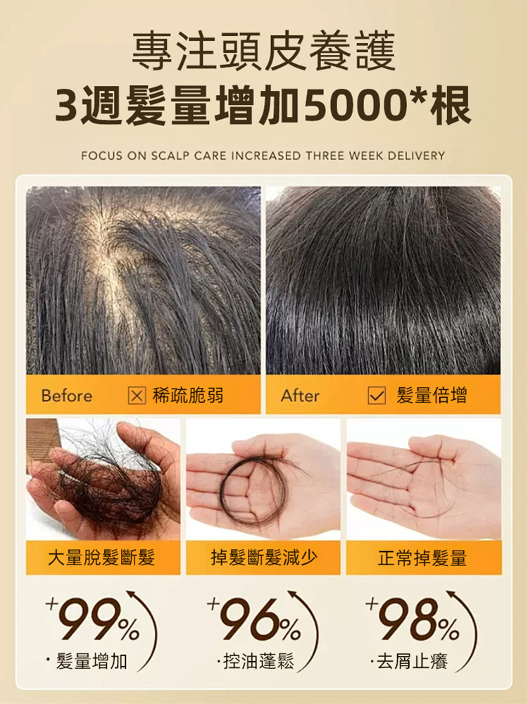 防脫育髪強韌髮根滾珠精華，睡前滾一滾，長出茂密黑髮，不打針不吃藥還你漆黑頭髮