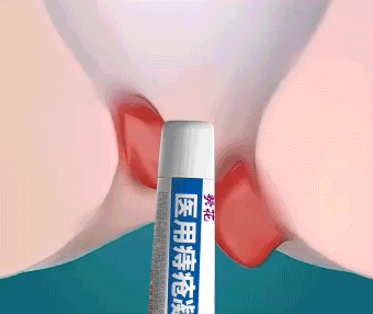 4.gif