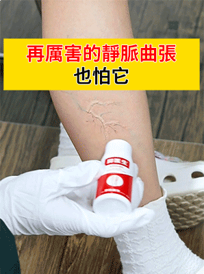 静脉曲张-(11).gif