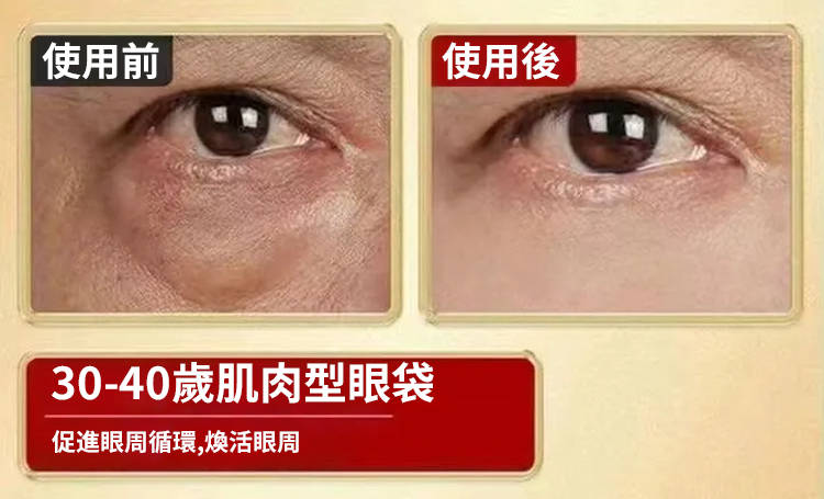 翻译件-SL-眼部黄芪精华抗皱眼部抗皱精华油-1240992-系统_14.png
