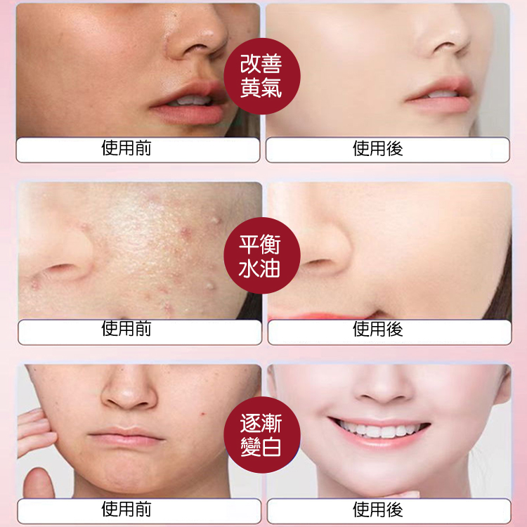 雪柔雅美白洗面奶