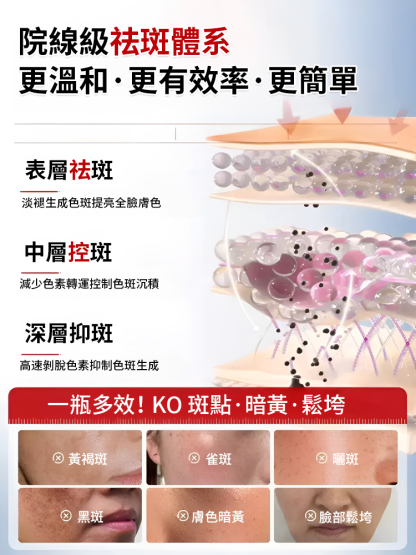 【全新升級】377Pro美白祛斑乳霜，皮膚暗沉，斑點皺紋，褶皺毛孔粗大，早用早享受