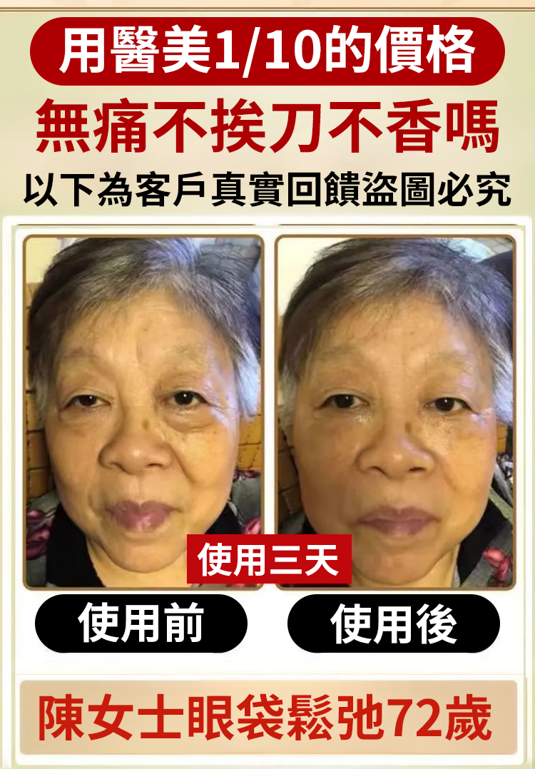 翻译件-SL-眼部黄芪精华抗皱眼部抗皱精华油-1240992-系统_10.png