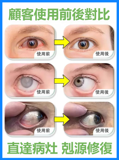 潤目型醫用退燒凝膠