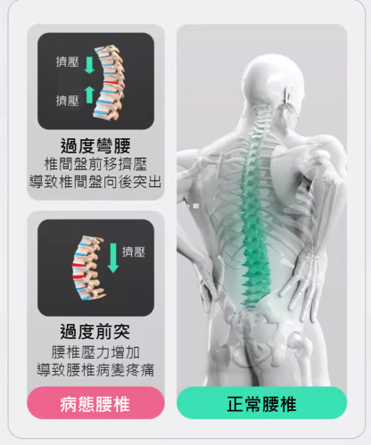 【加強型】久坐久站矯正護腰帶，人体仿生工学设计，多侧支撑你的腰部和腰肌，让你久坐不累腰
