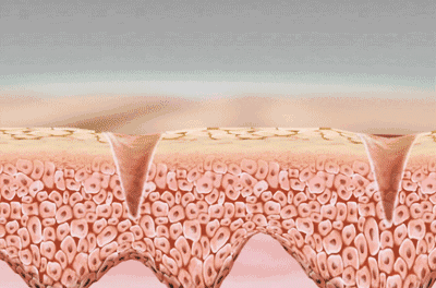 cbefe2974a6bfdbfa027337679c160ee.gif