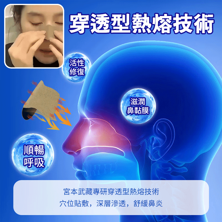 【一貼鼻通透】鼻炎穴位貼