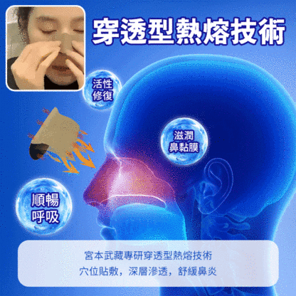 【一貼鼻通透】鼻炎穴位貼