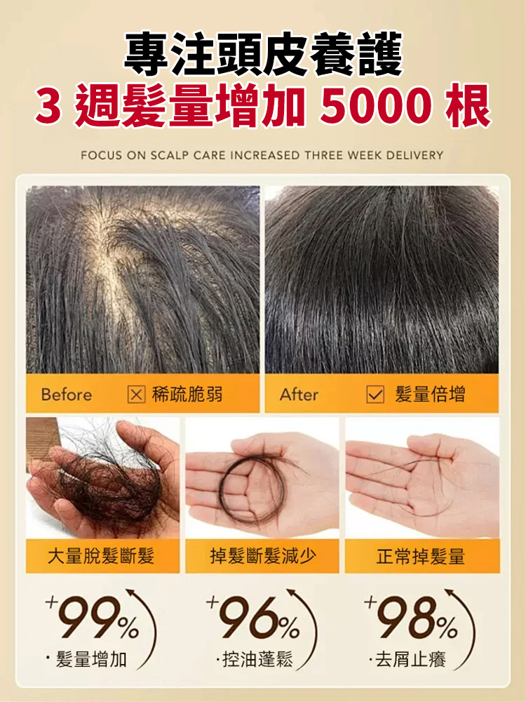 生薑防脫滾珠育髮液