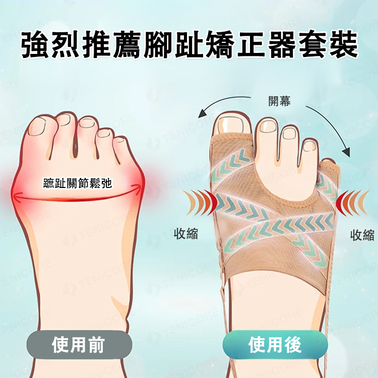 網布拇指外翻大腳趾矯形套，讓你輕鬆穿戴，分階段矯正你的腳趾頭防止繼續外翻惡化嚴重甚至大腿小腿變形