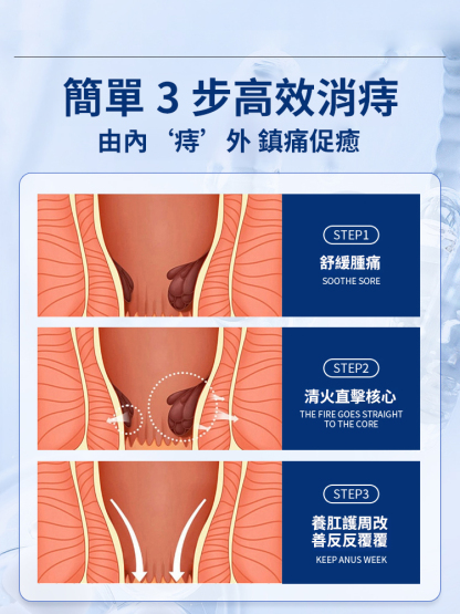無痛修復醫用痔瘡凝膠-7天消痔瘡，解決你的難言之隱，告別有痔人群