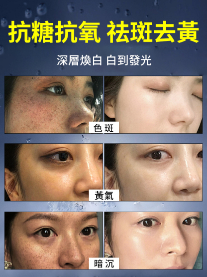 【全新升級】377Pro美白祛斑乳霜，皮膚暗沉，斑點皺紋，褶皺毛孔粗大，早用早享受