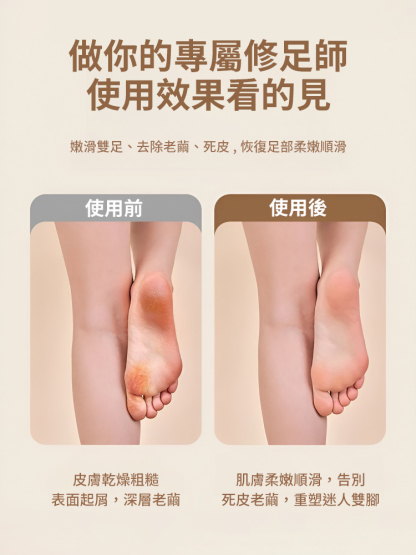 【輕鬆去死皮】數位電動磨腳器，爆款新品，不費勁還省力，磨得超光滑，只去死皮不傷皮膚