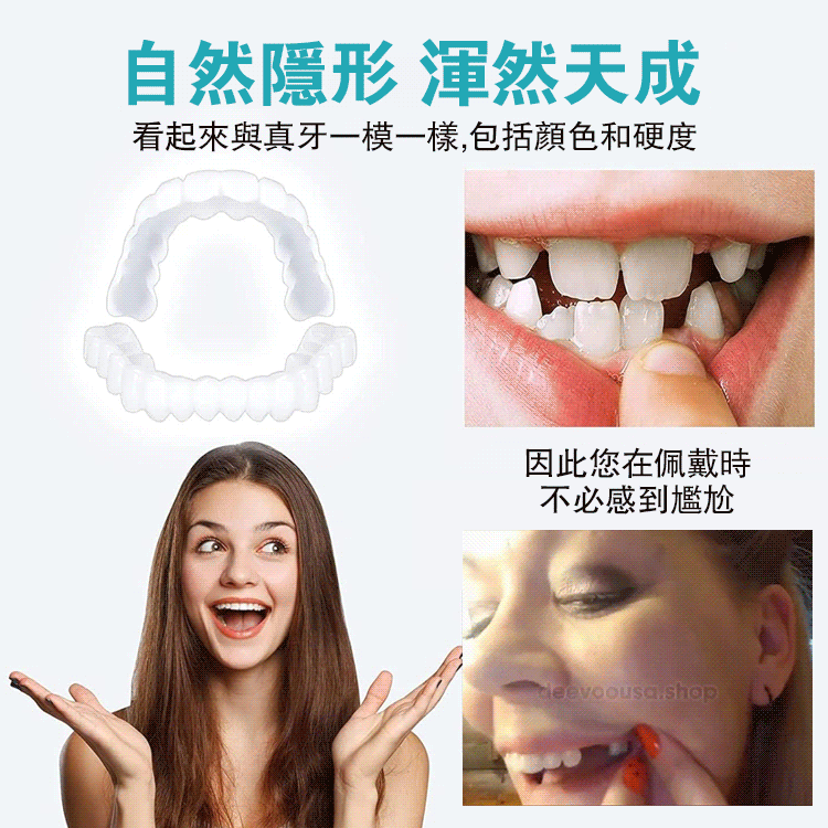 可調節卡扣式假牙，還你自信美白笑容，25年爆款