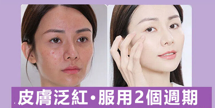 刺梨乾