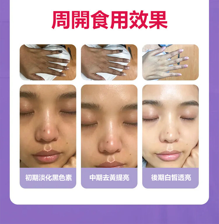 刺梨乾