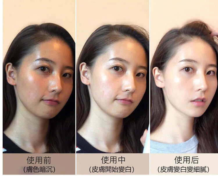 刺梨乾