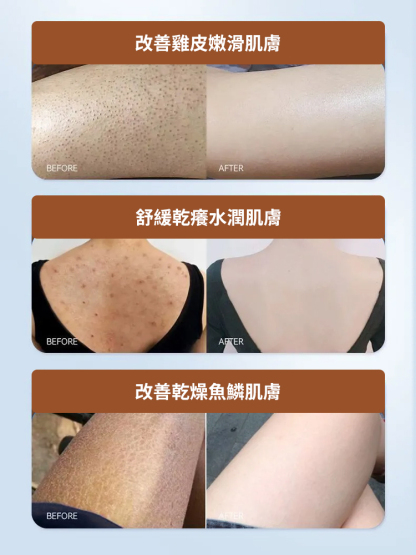身體舒緩奶油棒