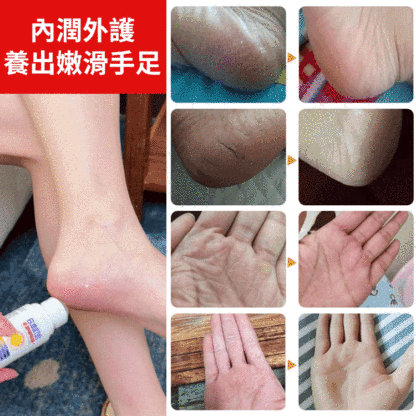 日本滋潤足部皴裂膏