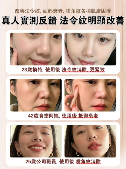 透明質酸鈉抗皺睡眠紋貼