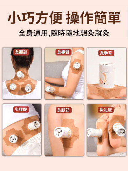 【中醫館都在用】去濕排毒古法懸灸筒