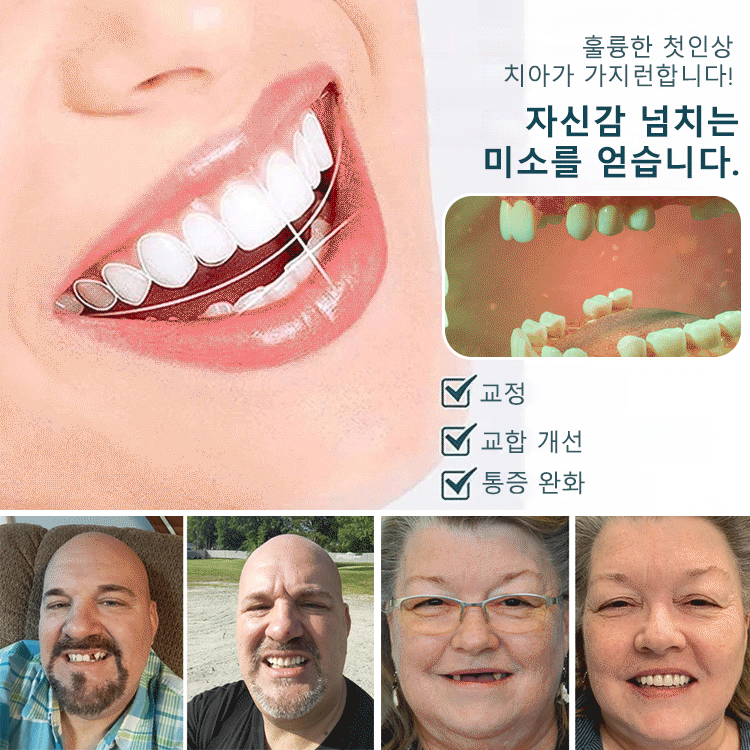 완벽한 미소 틀니 세트