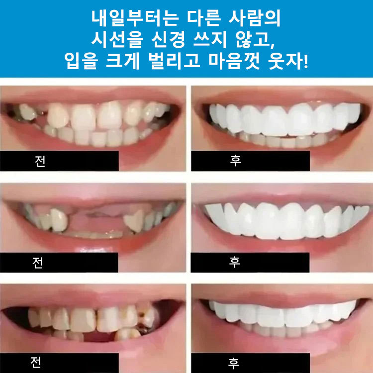 완벽한 미소 틀니 세트