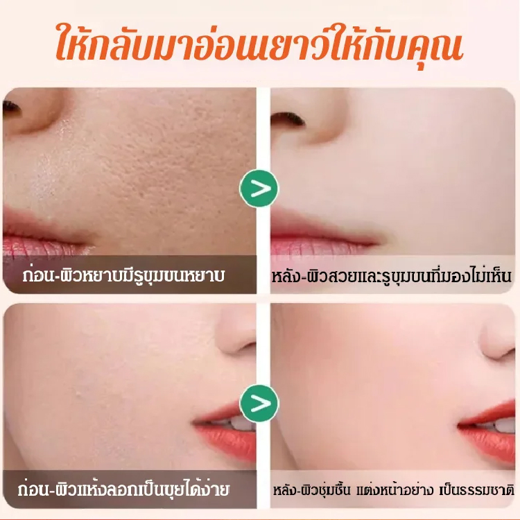 ครีมปรับสีผิว วิตามินซีห้าเท่า