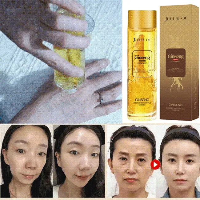 【อายุน้อยกว่า 30 ปี】เซรั่มสกัดจากโสม