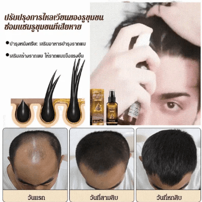 (รุ่นขายนิยม) สเปรย์ป้องกันผมร่วง ปลูกผม ไบโอติน เสริมเส้นผมแข็งแรง ซ่อมรากผม
