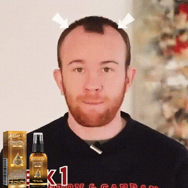 (รุ่นขายนิยม) สเปรย์ป้องกันผมร่วง ปลูกผม ไบโอติน เสริมเส้นผมแข็งแรง ซ่อมรากผม