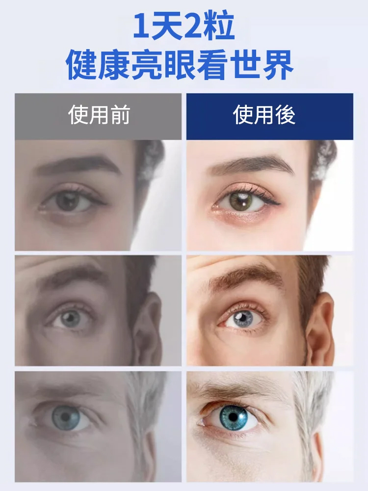 黑加侖藍莓葉黃素酯片葉
