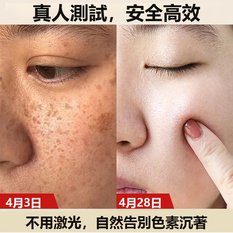 爆款潤凰黃芪淡斑霜