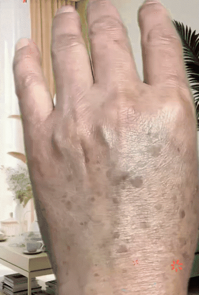 【老斑黃斑一抹消】淡斑尿素霜,Nicor維生素E尿素霜補水防凍防幹裂潤膚乳保濕身體乳100克每瓶 【老斑黃斑一抹消】淡斑尿素霜1729678871725815_12.gif