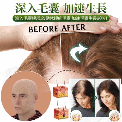生薑頭髮生長精華液