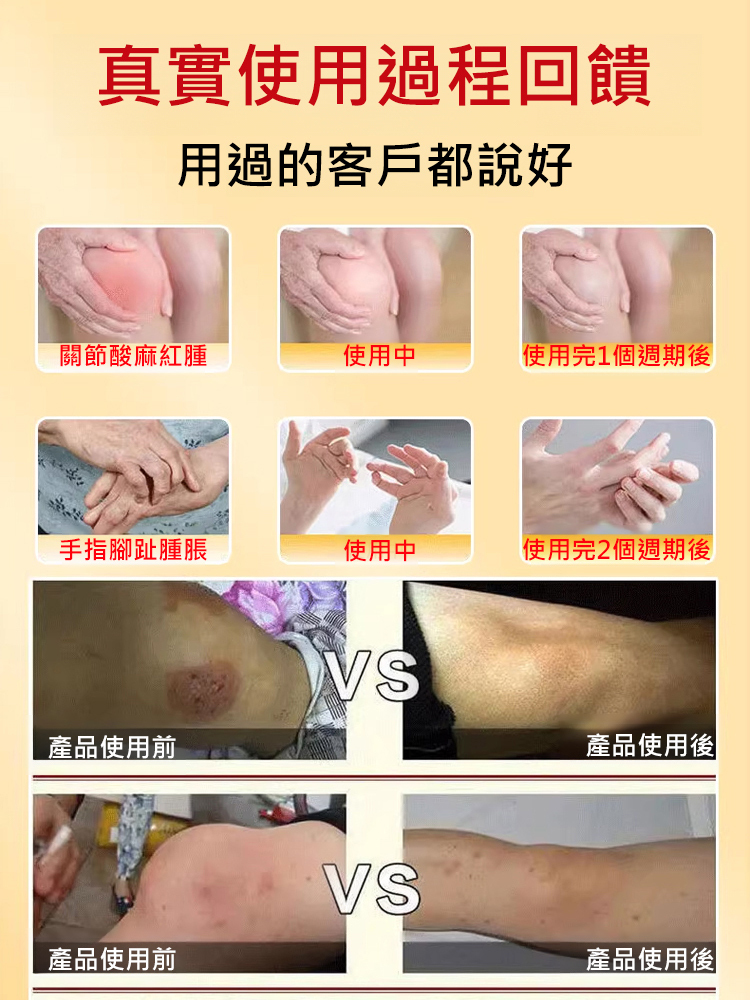 【專攻關節問題】國醫世家苗灸液
