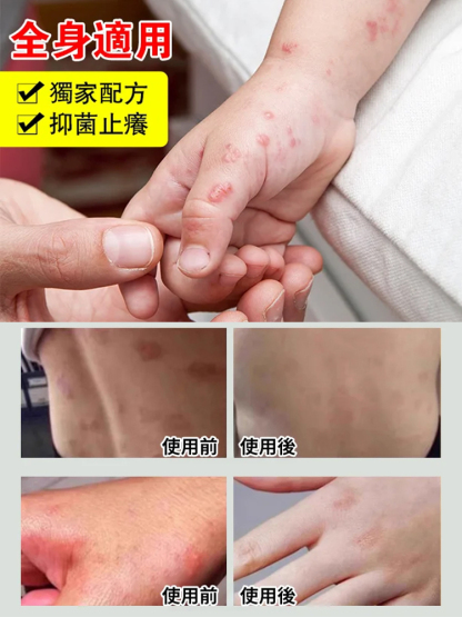 【拔毒止癢】苗疆百草膏