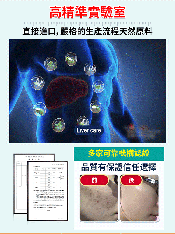 奶薊草籽油人參葛根黃耆片