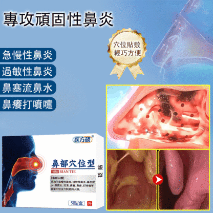【一貼通暢】鼻炎穴位砭貼