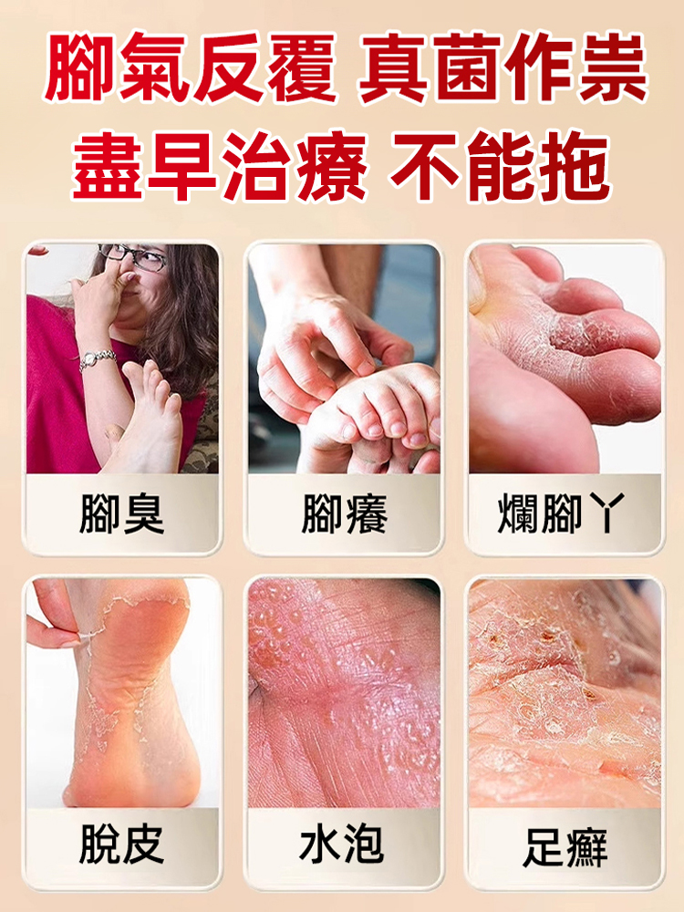 硫磺腳氣王止癢除菌足部護理
