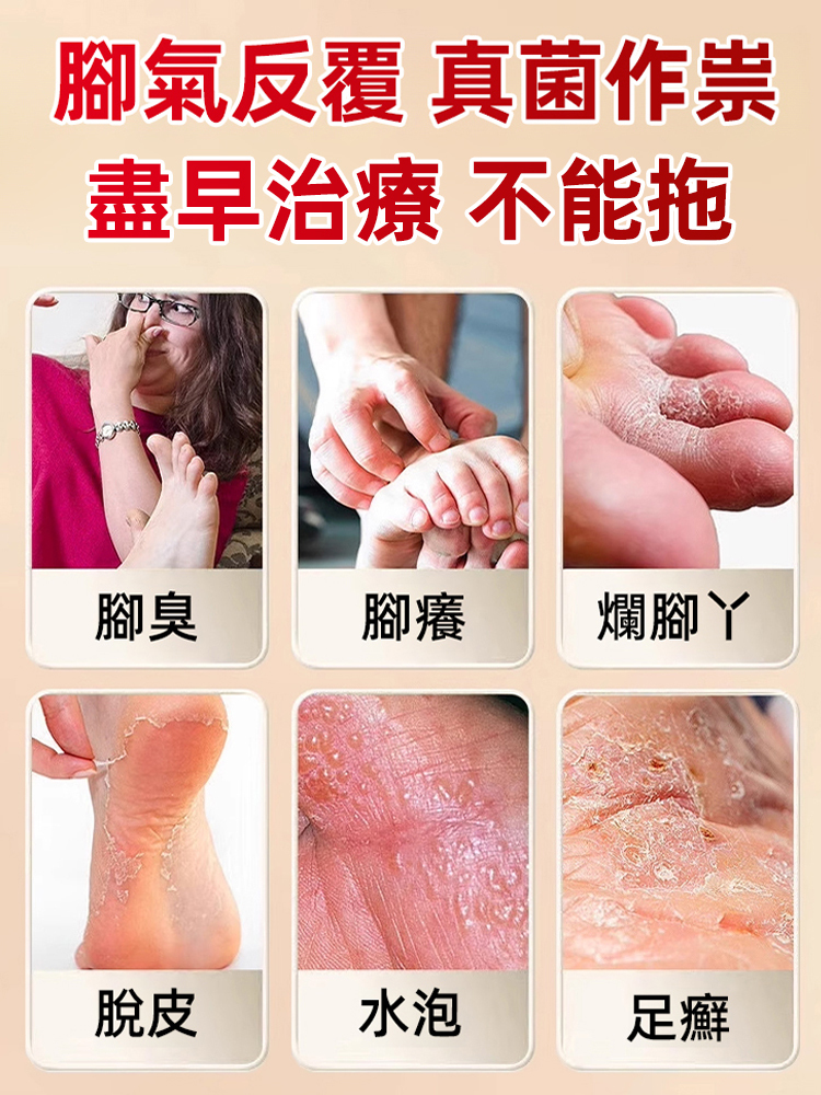 硫磺腳氣王止癢除菌足部護理