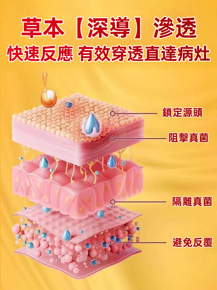 硫磺腳氣王止癢除菌足部護理