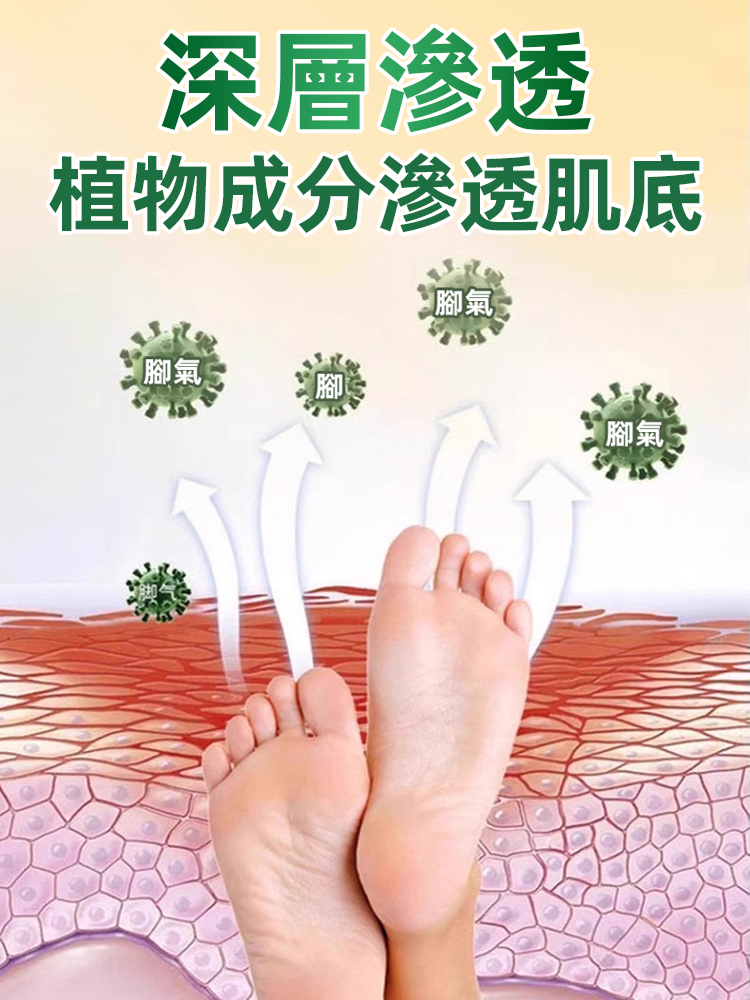 硫磺腳氣王止癢除菌足部護理