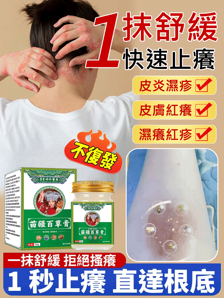 【拔毒止癢】苗疆百草膏